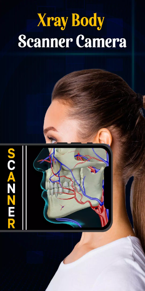 X Ray Mobile V.2.0